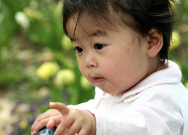 日本一岁八个月的孩子患脑肿瘤，开颅手术！失去声音「连载1」