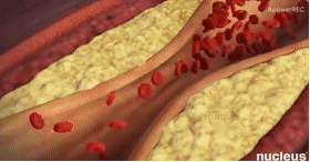 好好的血管怎么就堵了？这些“通血管”方法坑你没商量！