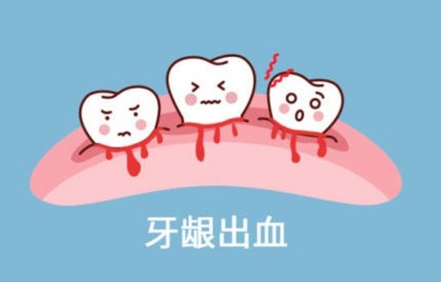 刷牙出血、咬苹果也出血，多是脾不统血，仅用三味药，补脾益气