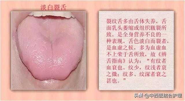 「舌诊科普」中医医生总看舌头都在看什么？奉上珍贵的舌诊图谱