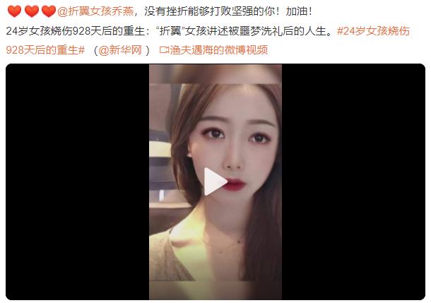 乔燕：因汽车自燃被烧伤，全脸毁容双手截肢，928天后涅槃重生