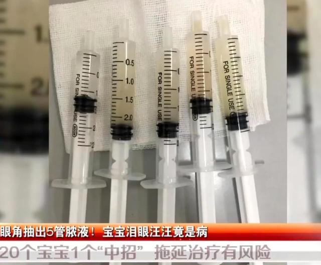 4个月大婴儿眼角抽出5管脓液！20个宝宝1个中招，拖延治疗有风险