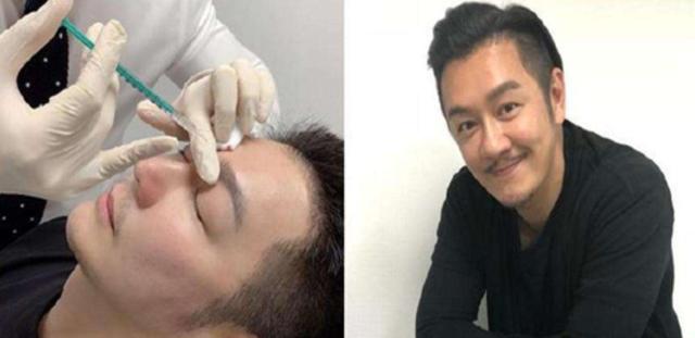 明星频翻车医美需谨慎！有人脸变充气气球，有人下巴变天气预报