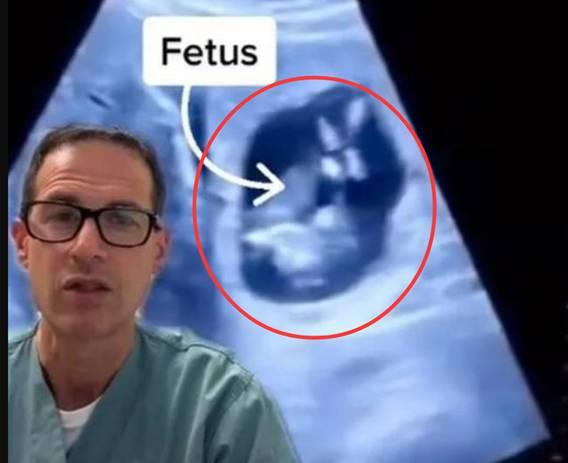 全球不足30例！广西一女子怀孕，胎儿却长在肝脏里，能生下来吗？