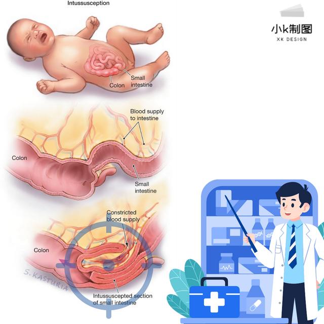 小儿腹胀说不出？出现这12种病症需要家长们留心注意