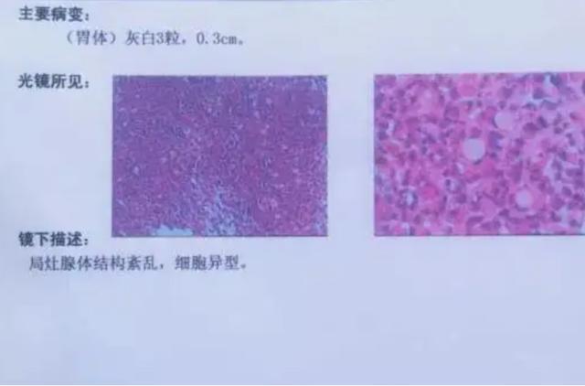 北大孝子顾颐：2015年带癌症父亲环游澳洲，88天后结局十分暖心