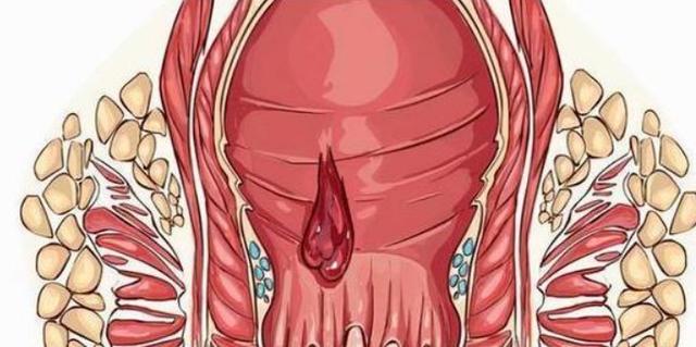 大便总感觉拉不干净、拉不完？可能是身体在告诉你这儿出问题了