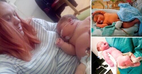 新生宝宝体重超13斤 被判定为英国第三大婴儿