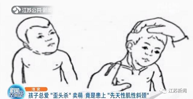 孩子总爱“歪头杀”卖萌？小心！可能是得了这种病