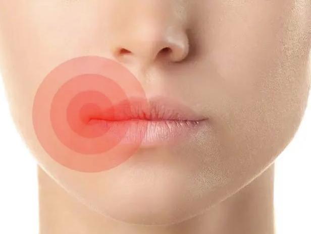 “脾开窍于口，其华在唇”从宝宝唇齿辨别身体状况