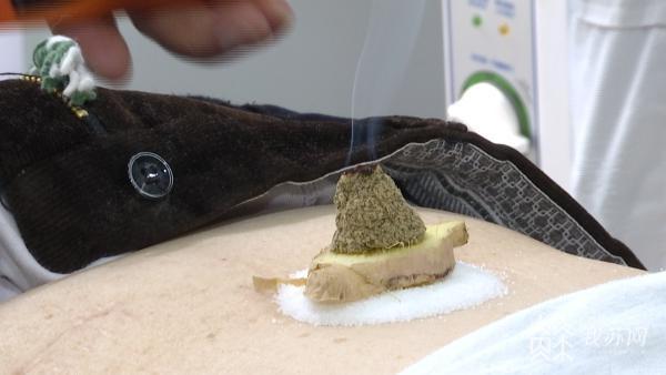 三九灸、养胃膳、冬日禁忌：这篇冬季养生纯干货请收藏