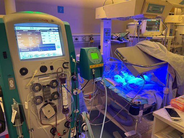 新生儿“持续性肾替代”治疗获成功