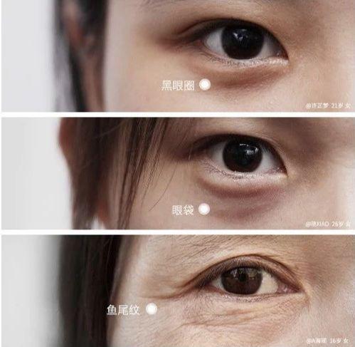 lancome眼霜 lancome眼霜