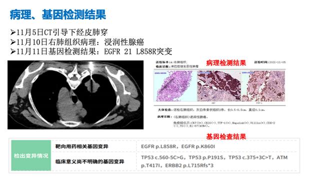 PPT檔案館｜一例國產三代TKI伏美替尼治療晚期肺腺癌的病例分享與思考