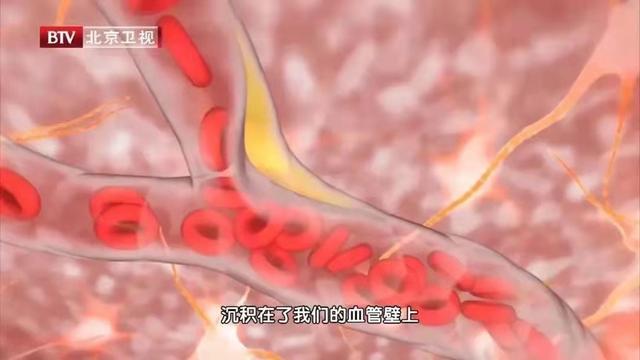 一颗大豆，含有6种“调脂成分”，好处太多！但怎么吃、怎么选很关键