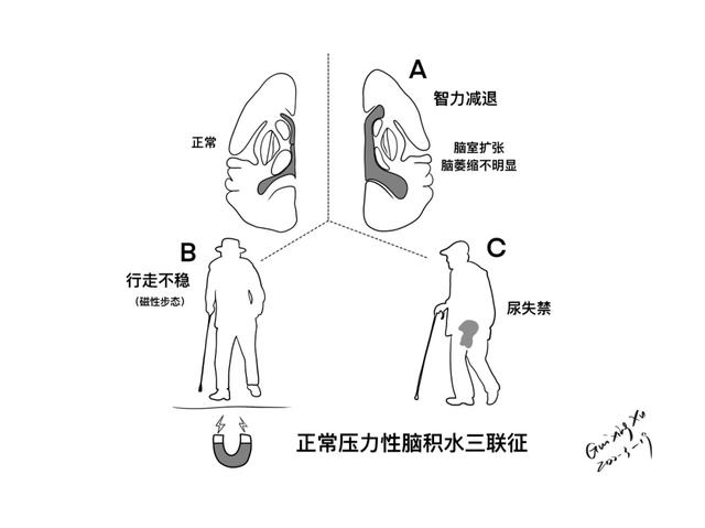 大脑皮层