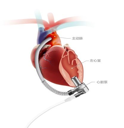 https://blog.sina.com.cn/s/blog_a654dd600102z14a.html