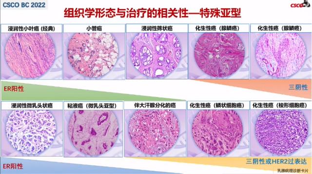 7大更新要點！專家解讀2022 CSCO乳腺癌指南病理診斷部分