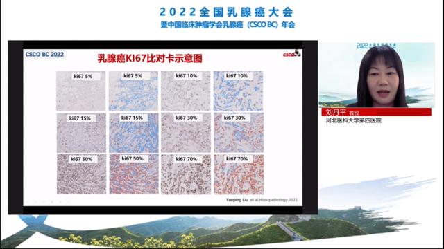 7大更新要點！專家解讀2022 CSCO乳腺癌指南病理診斷部分