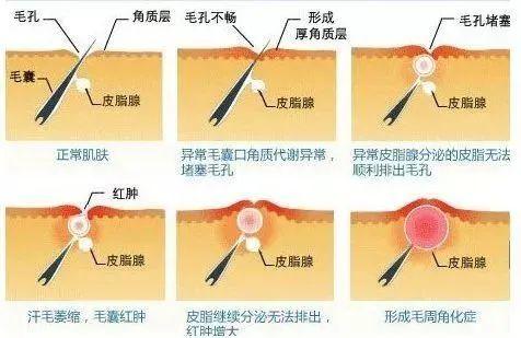 鸡皮肤突然光滑了