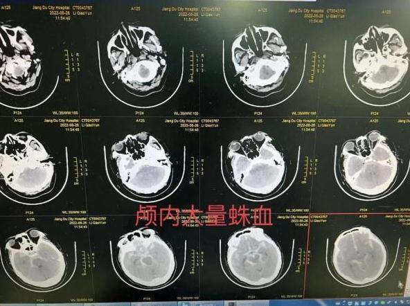 蟑螂吃鸽子屎「蟑螂冲水喝有什么好处」