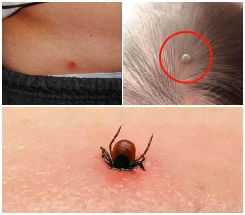 蚰蜒为什么不能踩死_怕什么，蚰蜒为什么不能踩死怕什么