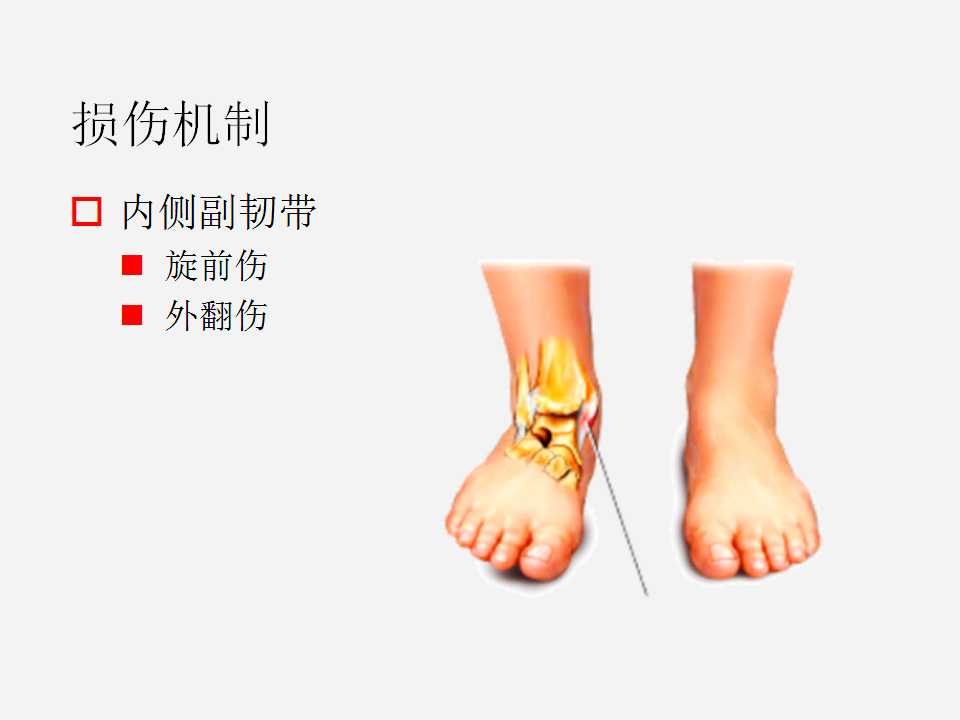脚崴了怎么办？