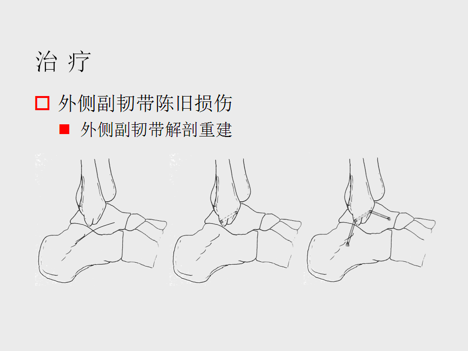 脚崴了怎么办？