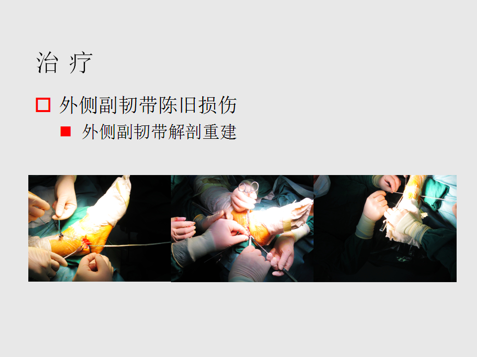 脚崴了怎么办？