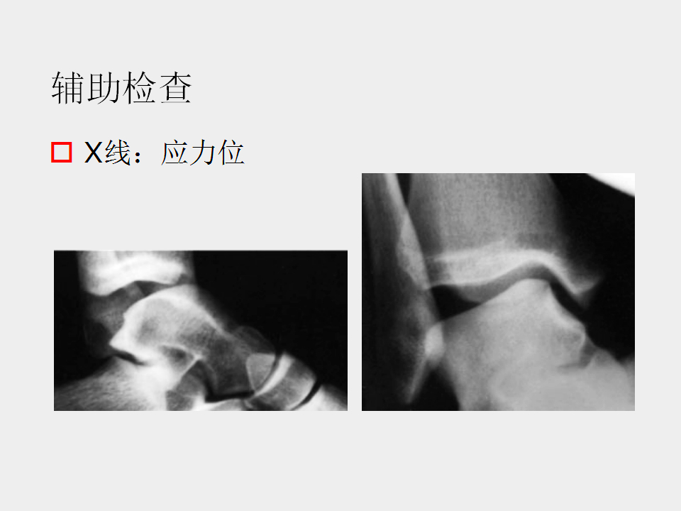 脚崴了怎么办？