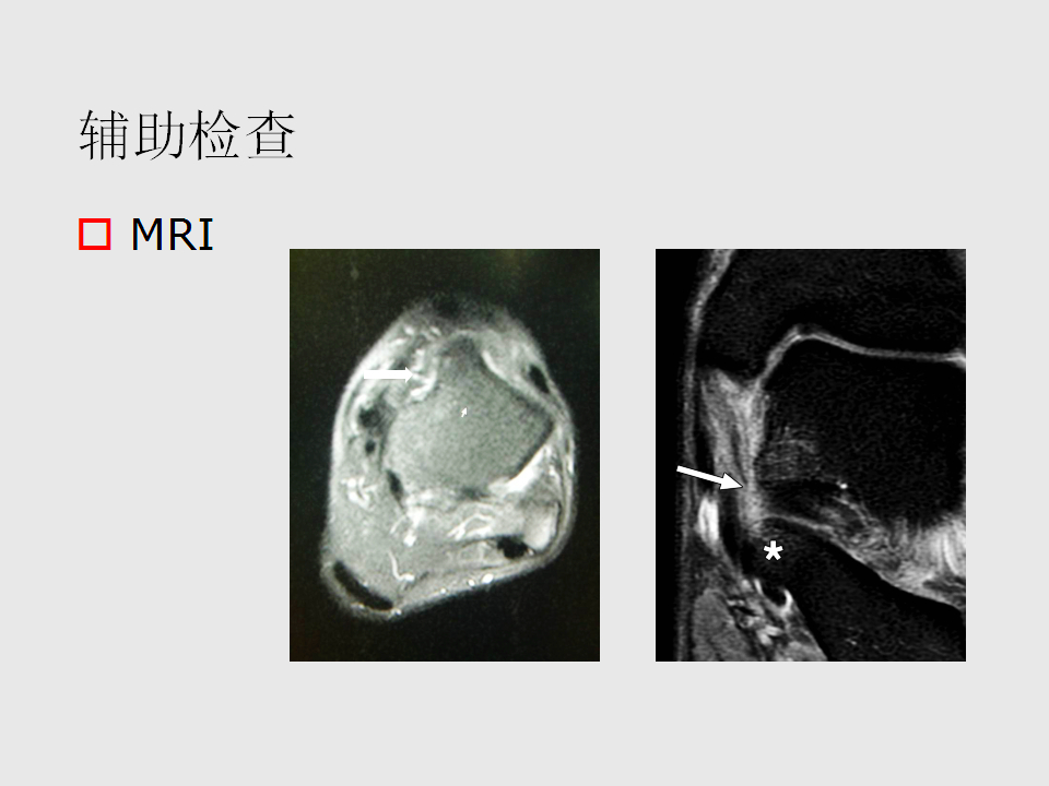 脚崴了怎么办？