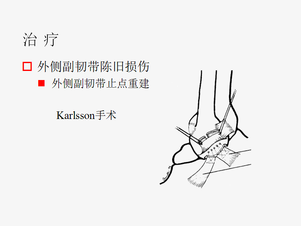 脚崴了怎么办？