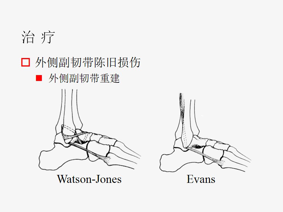脚崴了怎么办？