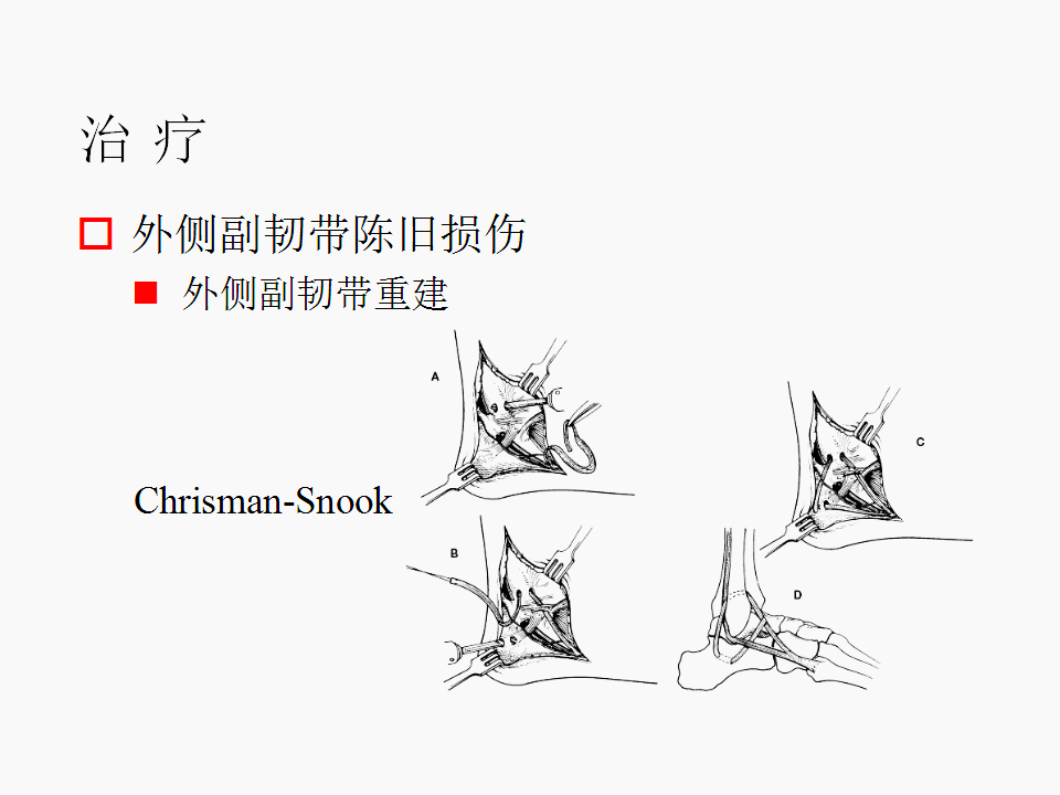 脚崴了怎么办？