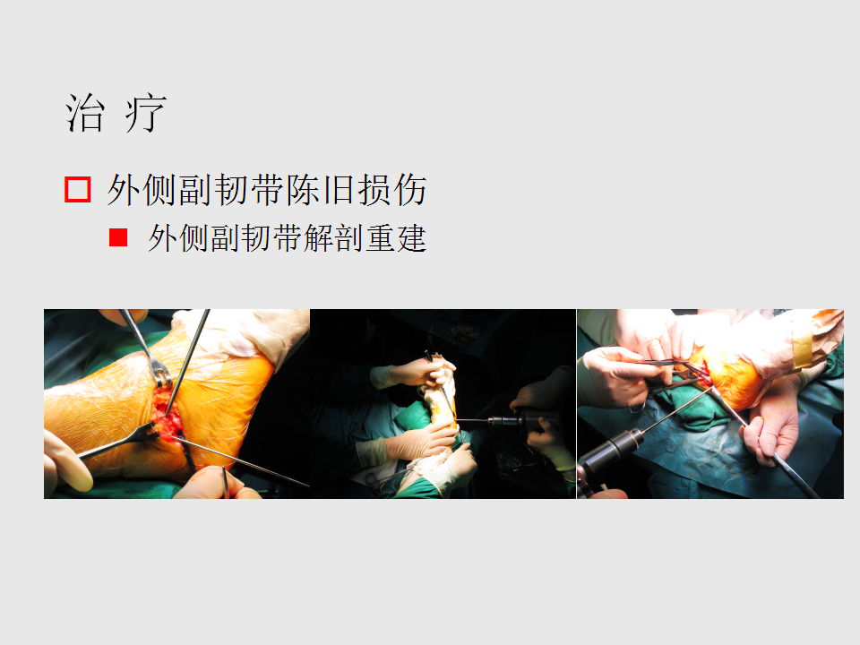 脚崴了怎么办？