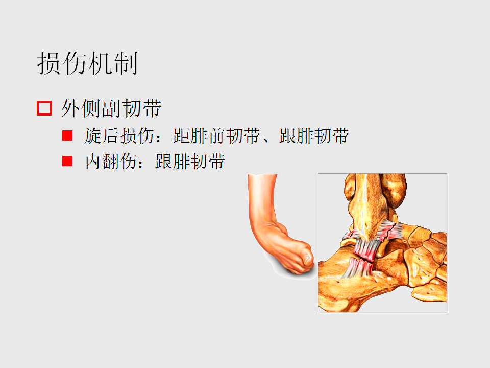 脚崴了怎么办？