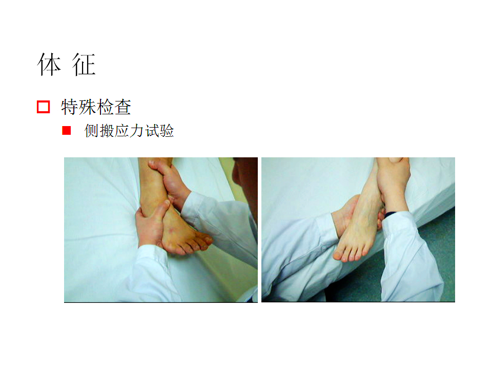 脚崴了怎么办？