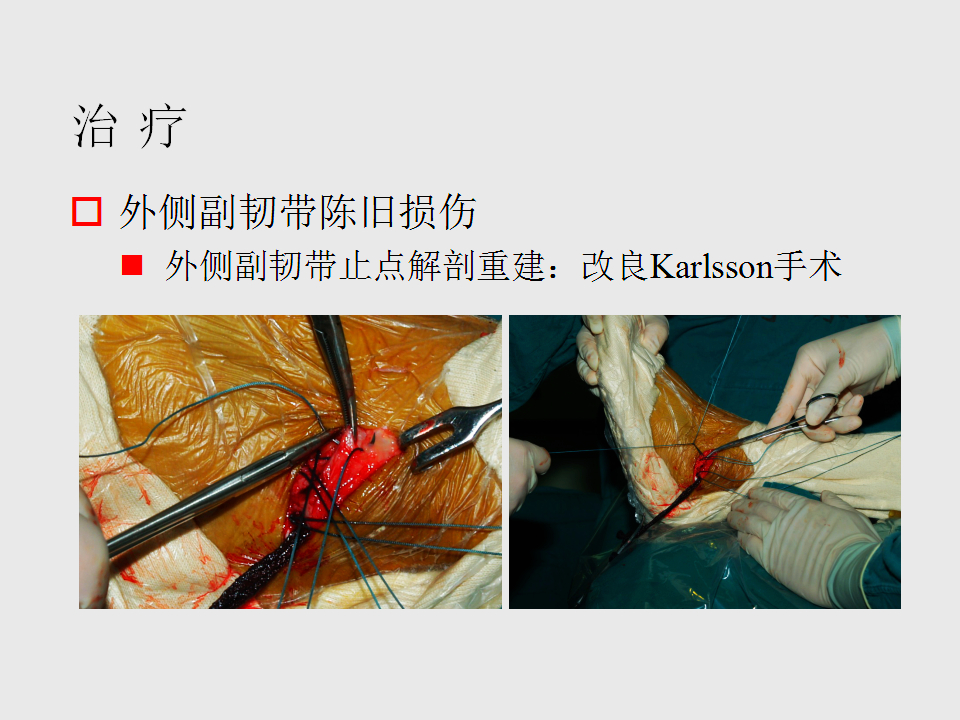 脚崴了怎么办？