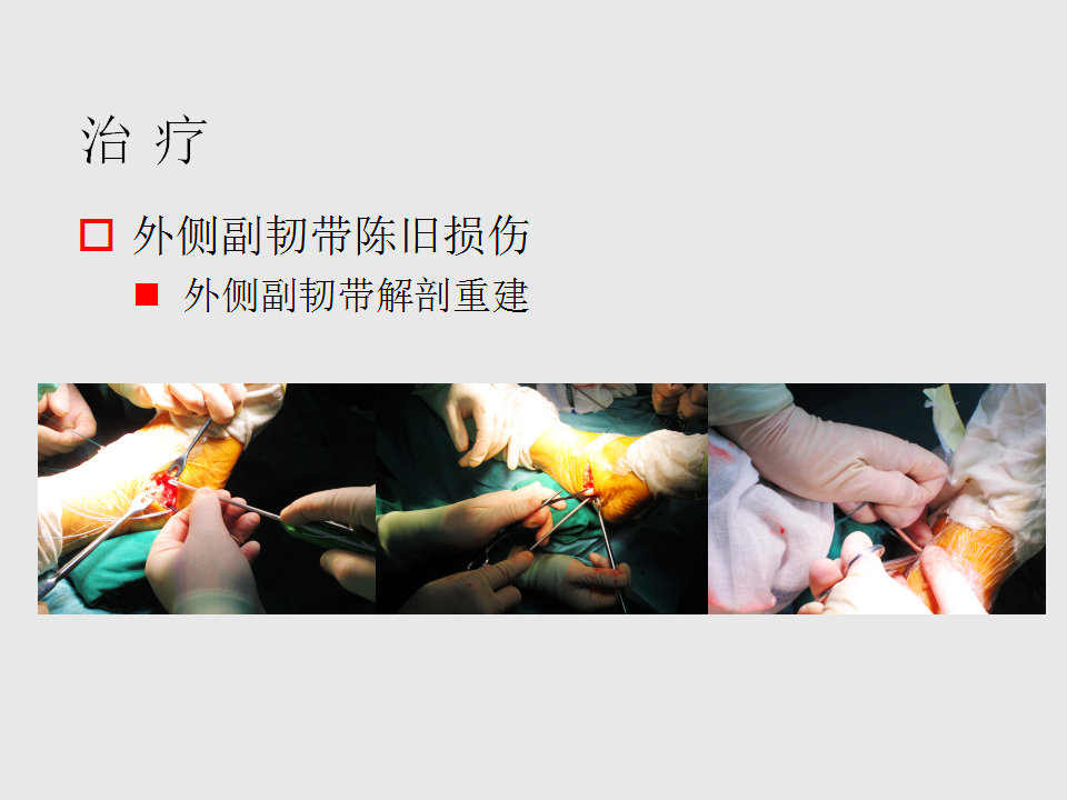脚崴了怎么办？
