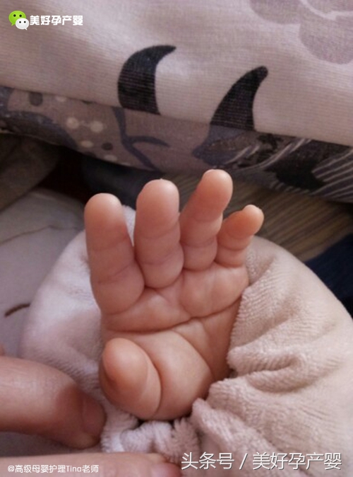 因为大多数唐氏宝宝都会存在断掌纹的特点,但是不代表断掌纹是宝宝