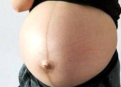 怀孕后肚子中线是什么，跟宝宝有什么关系？