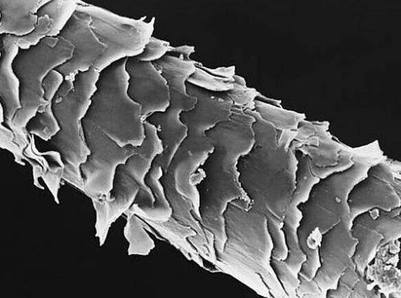 头发主要由表皮层,皮质层,膸髓质层组成,而表皮层是由许多细小的鳞片