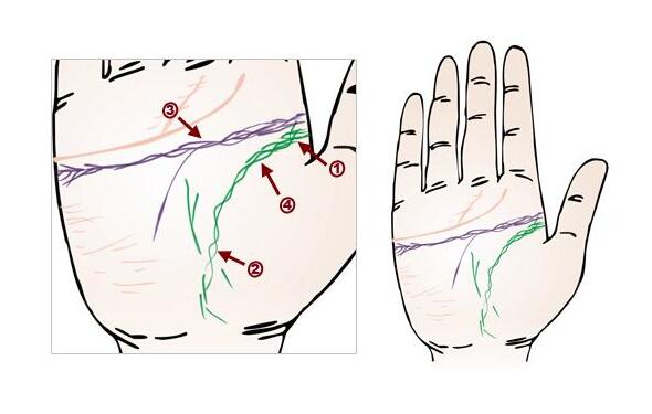 手相中生命线间断的意义