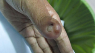 女幼师滑雪断指赖美甲？不当美甲存在这些隐患