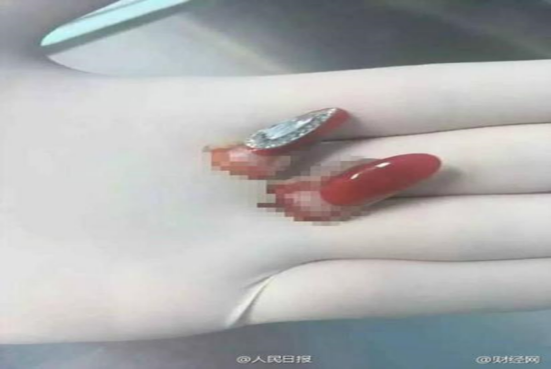 女幼师滑雪断指赖美甲？不当美甲存在这些隐患