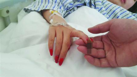 女幼师滑雪断指赖美甲？不当美甲存在这些隐患