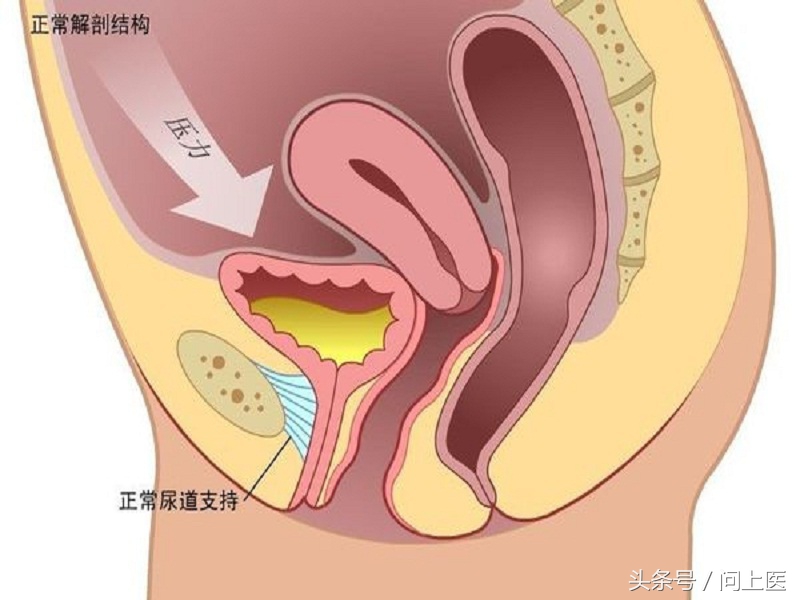 尿流动力学检查及注意事项