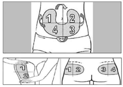 婴儿大腿接种部位图片(胰岛素注射部位是否有讲究) - 赤虎壹号