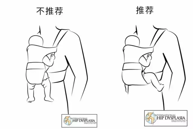 腰凳、背带用错了伤娃，记住 5 大原则才安心