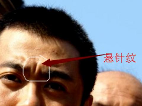 也称之为悬针破印,他是一个比较凶的纹路,像一根针一样穿过官禄宫到